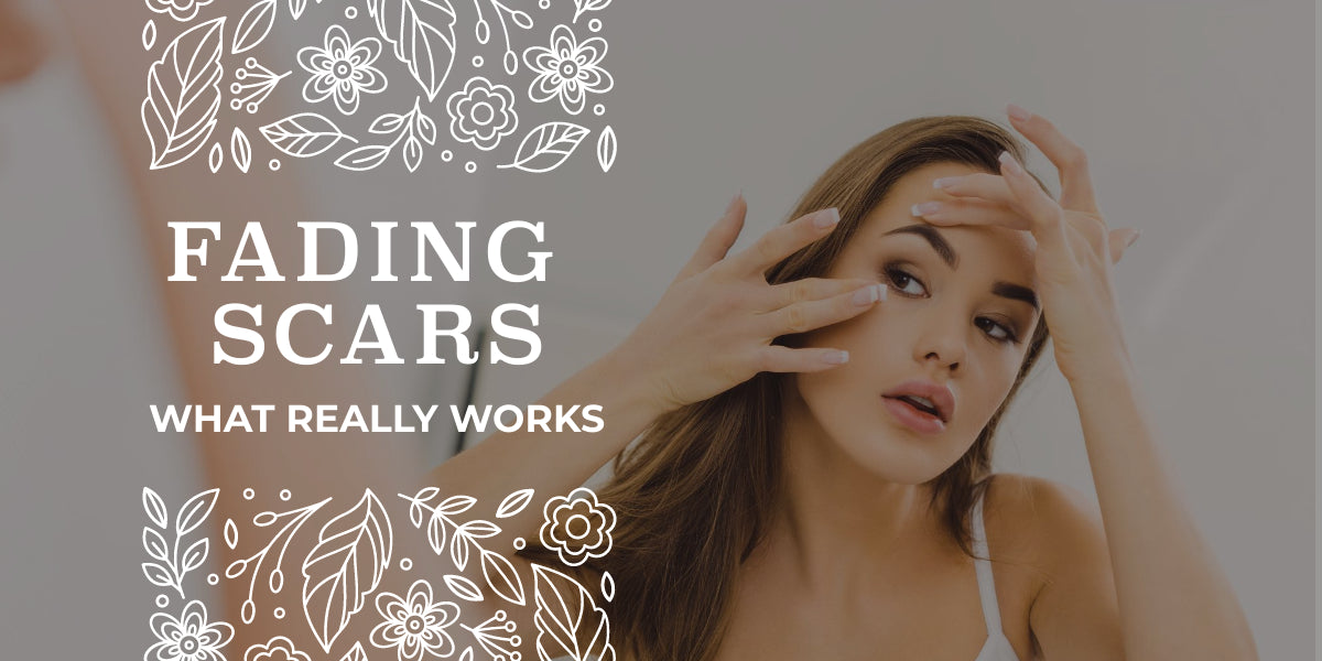 How To Fade Scars